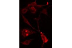 ABIN6274590 staining Hela cells by IF/ICC. (RALGAPA2 anticorps  (Internal Region))