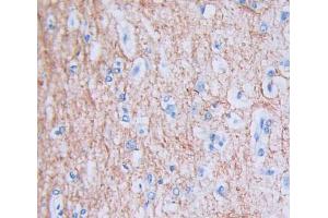 Used in DAB staining on fromalin fixed paraffin- embedded Kidney tissue (PUS1 anticorps  (AA 1-427))