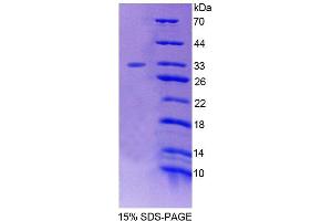 SDS-PAGE analysis of Human FOXO3 Protein.
