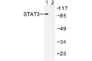 Image no. 1 for anti-Signal Transducer and Activator of Transcription 3 (Acute-Phase Response Factor) (STAT3) antibody (ABIN271827)