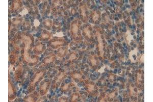 Detection of aHSP in Rat Kidney Tissue using Polyclonal Antibody to Alpha-Hemoglobin Stabilizing Protein (aHSP) (aHSP anticorps  (AA 2-102))