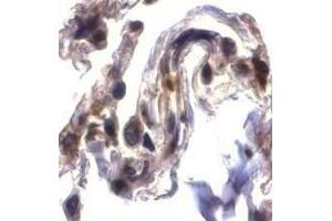 Immunohistochemical staining of ARTS in human lung tissue with ARTS antibody at 2μg/ml. (Septin 4 anticorps  (N-Term))