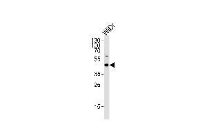 C9orf72 Antibody (C-term) (ABIN656852 and ABIN2846057) western blot analysis in WiDr cell lysate (35 μg/lane). (C9ORF72 anticorps  (C-Term))