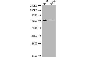 Western Blot Positive WB detected in: PC-3 whole cell lysate, Hela whole cell lysate All lanes: GLB1L3 antibody at 1:2000 Secondary Goat polyclonal to rabbit IgG at 1/50000 dilution Predicted band size: 75, 36 kDa Observed band size: 75 kDa (GLB1L3 anticorps  (AA 1-236))