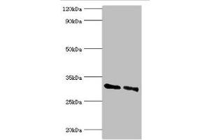 Western blot All lanes: KCTD15 antibody at 8 μg/mL Lane 1: 293T whole cell lysate Lane 2: Hela whole cell lysate Secondary Goat polyclonal to rabbit IgG at 1/10000 dilution Predicted band size: 32, 27 kDa Observed band size: 32 kDa (KCTD15 anticorps  (AA 1-234))