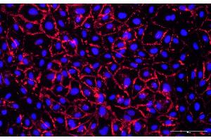 HUVEC cells were stained using a primary rabbit anti-human CD31 antibody, followed by detection with animal-free AlexaFluor555-conjugated anti-rabbit IgG secondary Multiclonal antibody (ABIN7581785).