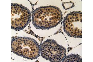 Used in DAB staining on fromalin fixed paraffin- embedded testis tissue