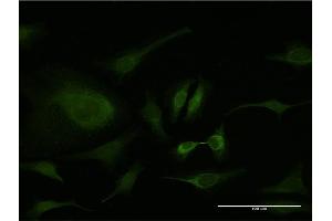 Immunofluorescence of monoclonal antibody to PCNA on HeLa cell.
