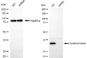 Western blotting analysis using pyridoxal kinase antibody (ABIN7800072). (PDXK anticorps)