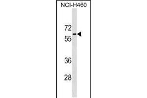 Western blot analysis in NCI-H460 cell line lysates (35ug/lane). (Phosphoglucomutase 5 anticorps  (C-Term))