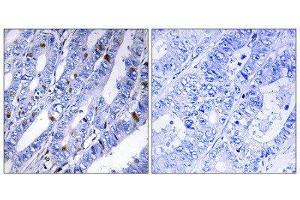 Immunohistochemistry (IHC) image for anti-Protein Kinase, CAMP-Dependent, Regulatory, Type II, beta (PRKAR2B) (Ser113) antibody (ABIN1848032)
