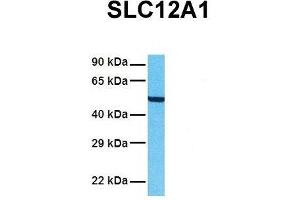 Host:  Rabbit  Target Name:  SLC12A1  Sample Tissue:  Human A549  Antibody Dilution:  1. (SLC12A1 anticorps  (N-Term))