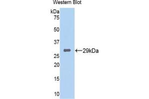 Western blot analysis of the recombinant protein. (TPSB2 anticorps  (AA 35-275))