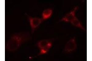 ABIN6266546 staining Hela cells by IF/ICC. (Glucagon anticorps)
