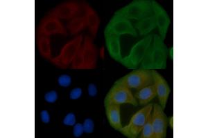 ABIN6258613 and ABIN6274911 staining Hela cells by IF/ICC.