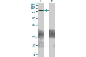 Western Blot analysis of ZBTB33 expression in transfected 293T cell line by ZBTB33 monoclonal antibody (M01), clone 2B2. (ZBTB33 anticorps  (AA 564-673))