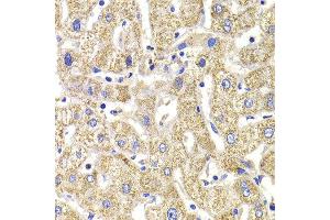 Immunohistochemistry of paraffin-embedded Human liver injury using KIF3A antibody at dilution of 1:100 (x400 lens). (KIF3A anticorps)