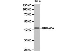 Western blot analysis of extracts of HeLa cells, using PRKACA antibody (ABIN5995919). (PRKACA anticorps)