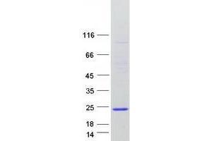 Validation with Western Blot