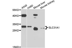 Western blot analysis of extracts of various cell lines, using SLC31A1 antibody (ABIN6003807) at 1/1000 dilution. (SLC31A1 anticorps)