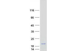 Validation with Western Blot
