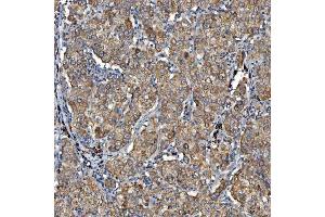 IHC analysis of SDF2L1 using anti-SDF2L1 antibody (ABIN7601111). (SDF2L1 anticorps  (AA 29-221))