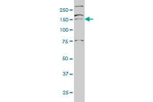 AATK monoclonal antibody (M03), clone 5B8 Western Blot analysis of AATK expression in Hela S3 NE .