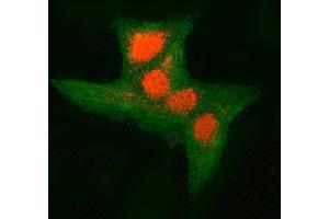 IF analysis of RNF34 and Tubulin beta using anti-RNF34 antibody (ABIN7602457) and anti-Tubulin beta antibody (ABIN7602744).