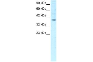 WB Suggested Anti-FOSB Antibody Titration:  1.