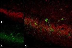 Expression of SSTR4 in rat hippocampus - Immunohistochemical staining of rat hippocampus using Anti-Somatostatin Receptor Type 4 (extracellular) Antibody, (ABIN7043766, ABIN7045265 and ABIN7045266).
