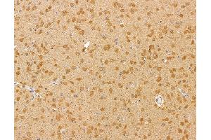 ABIN6260322 and ABIN6279883 at 1/100 staining rat brain tissue by IHC-P.