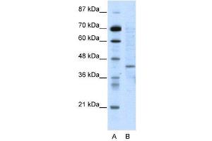 WB Suggested Anti-RING1  Antibody Titration: 5. (RING1 anticorps  (N-Term))