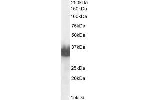 ABIN6391379 (0. (Prostate Specific Antigen anticorps  (C-Term))