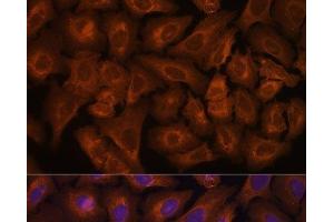 Immunofluorescence analysis of U-2 OS cells using NEXN Polyclonal Antibody at dilution of 1:100. (NEXN anticorps)