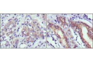 anti-Cerberus 1 Homolog (Xenopus Laevis) (CER1) antibody