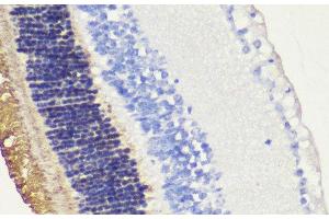 Immunohistochemistry of paraffin-embedded Mouse retina using RHO Polyclonal Antibody at dilution of 1:200 (40x lens). (Rho-related GTP-binding protein anticorps)