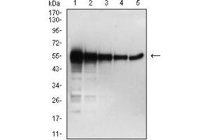 Western blot analysis using SARS-CoV-2-NP2 mAb against human SARS-CoV-2-N (AA: 1-419) recombinant protein. (SARS-Cov2-NP2 (AA 120-300) anticorps)