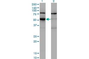 Western Blot analysis of ZSCAN21 expression in transfected 293T cell line by ZNF38 monoclonal antibody (M09), clone 4B3. (ZSCAN21 anticorps  (AA 1-473))