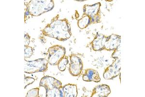 Immunohistochemistry of paraffin-embedded human colon carcinoma using CD38 Rabbit pAb (ABIN3015544, ABIN3015545, ABIN1679089 and ABIN6218776) at dilution of 1:150 (40x lens).