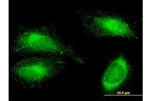 Immunofluorescence of purified MaxPab antibody to FN1 on HeLa cell. (Fibronectin 1 anticorps  (AA 1-163))