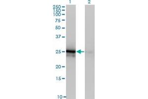 Western Blot analysis of FGF21 expression in transfected 293T cell line by FGF21 monoclonal antibody (M03), clone 3G10. (FGF21 anticorps  (AA 30-209))