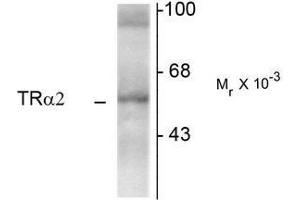 Western Blotting (WB) image for anti-Thyroid Hormone Receptor, alpha (THRA) (N-Term) antibody (ABIN371845) (THRA anticorps  (N-Term))