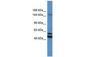 Image no. 1 for anti-Zinc Finger Protein 261 (ZMYM3) (N-Term) antibody (ABIN6746153) (ZMYM3 anticorps  (N-Term))