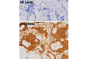 Immunohistochemistry (IHC) image for anti-Receptor tyrosine-protein kinase erbB-2 (ErbB2/Her2) (C-Term) antibody (ABIN6254225)