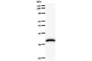 Western Blotting (WB) image for anti-FtsJ RNA Methyltransferase Homolog 2 (FTSJ2) antibody (ABIN931161) (FTSJ2 anticorps)