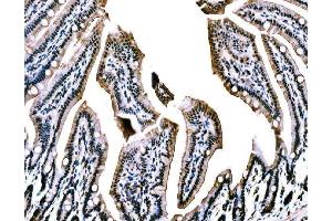 IHC analysis of WAPL/FOE using anti-WAPL/FOE antibody (ABIN7602663). (WAPAL anticorps  (AA 916-1190))