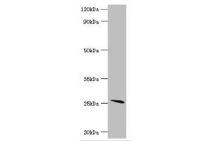 Western blot All lanes: Glutathione S-transferase A2 antibody at 4 μg/mL + Mouse liver tissue Secondary Goat polyclonal to rabbit IgG at 1/10000 dilution Predicted band size: 26 kDa Observed band size: 26 kDa
