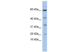 WB Suggested Anti-LMO2 Antibody Titration:  0. (LMO2 anticorps  (N-Term))