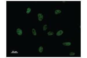Immunostaining analysis in HeLa cells. (BCL3 anticorps)