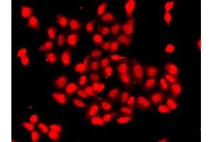Immunofluorescence analysis of A549 cell using CAMK1D antibody. (CAMK1D anticorps)